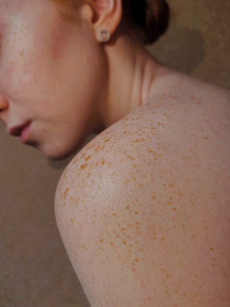 Skin marks